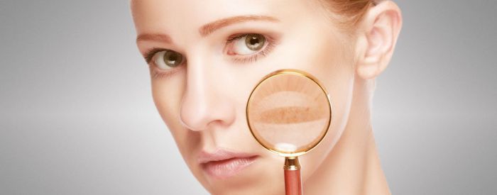 Pigmentation Reduction in Plymouth