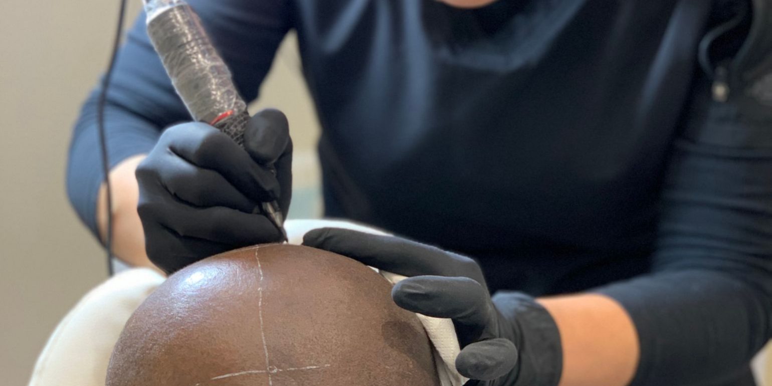 Scalp Micropigmentation in Plymouth
