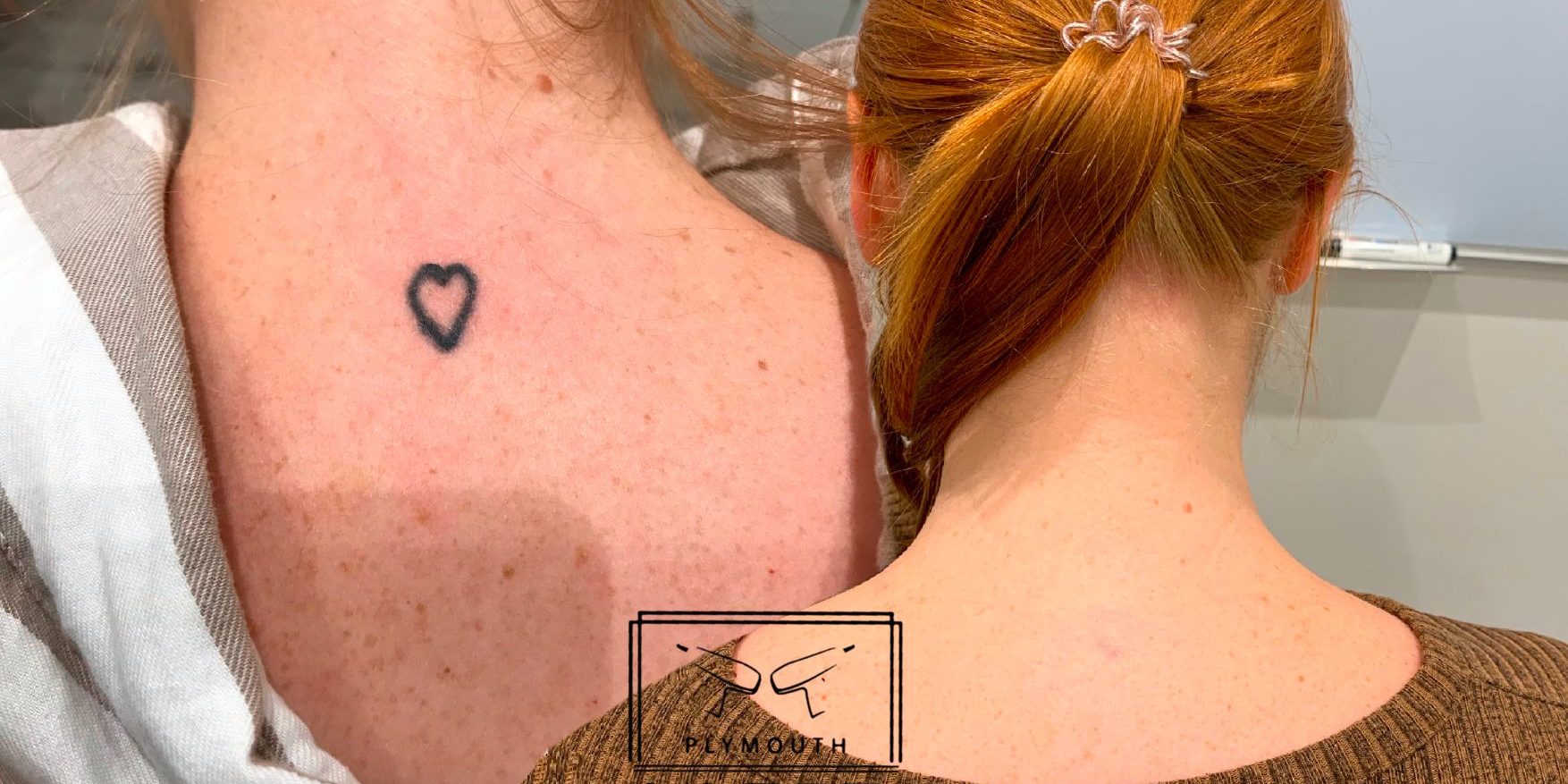 Laser Tattoo Removal in Plymouth