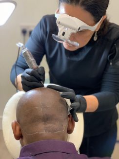Scalp Micropigmentation in Plymouth