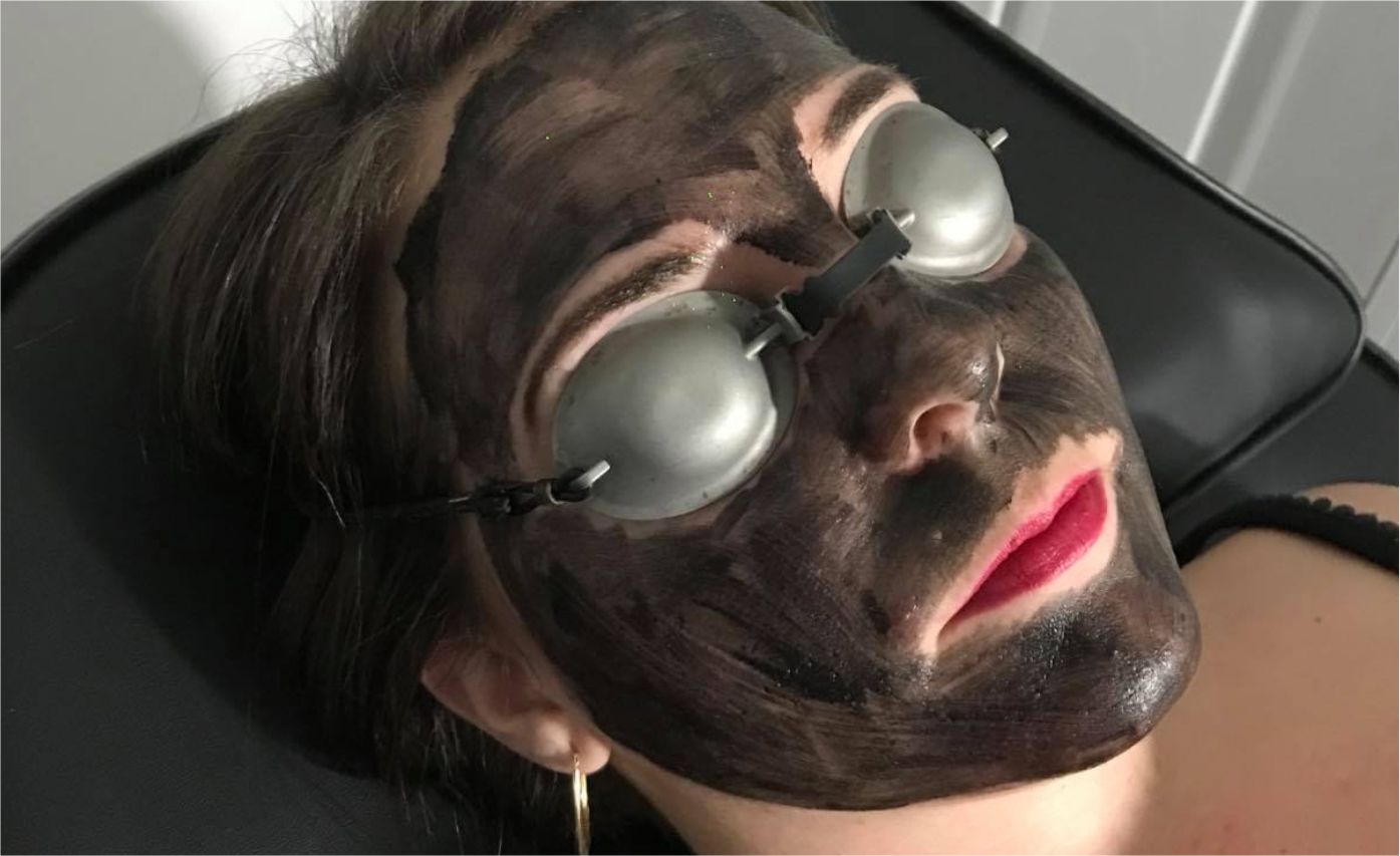 Carbon Skin Rejuvenation In Plymouth